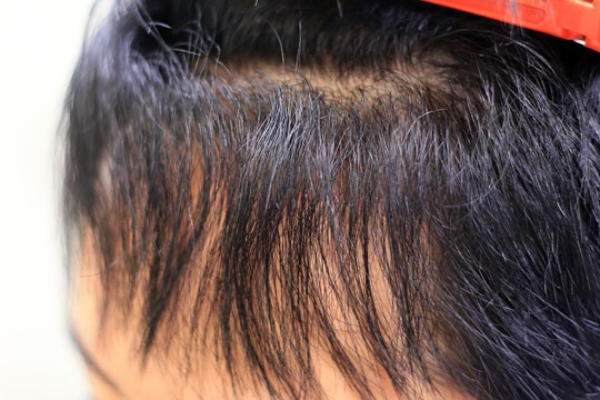 ビビリのある髪に酸性縮毛矯正 ショートヘアとボブスタイルの方が多いヘアサロン オーパス21 近鉄とjr永和から徒歩8分