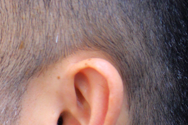 耳と髪が生えている位置の隙間
