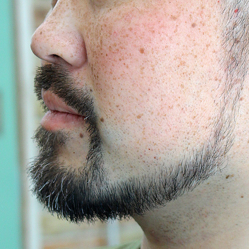 髭カット・ヒゲトリミング・ヒゲカットアフター