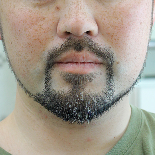 髭カット・ヒゲトリミング・ヒゲカットアフター